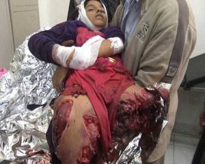 %d8%a7%d8%b3%d8%aa%d8%b4%d9%87%d8%a7%d8%af-%d8%b7%d9%81%d9%84%d8%a9-%d9%81%d9%8a-%d8%aa%d8%b9%d8%b24